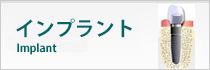 インプラント