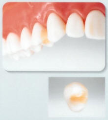 �I�[���Z���~�b�N