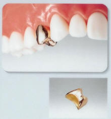 �S�[���h�N���E��