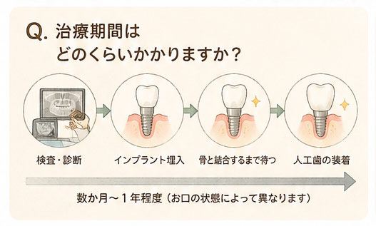 Q. 治療期間はどのくらいかかりますか？