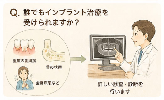 Q. 誰でもインプラント治療を受けられますか？