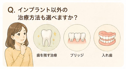 Q. インプラント以外の治療方法も選べますか？