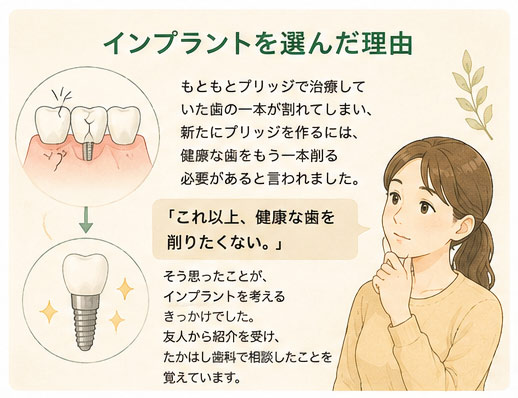 インプラントを選んだ理由